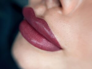 Cách xử lý môi bị thâm lại đúng chuẩn chuyên gia