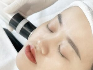 Công nghệ Plasma lạnh 2026 hỗ trợ lành thương nhanh