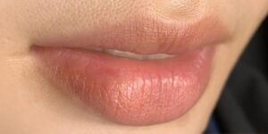 Nguyên nhân môi thâm mãi không hồng dù đã phun nhiều lần