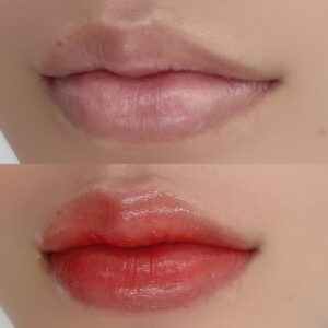 Khử thâm môi xong bao lâu thì lên màu hồng tự nhiên?