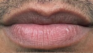 Kỹ thuật Dark-to-Light 2026 cho môi thâm