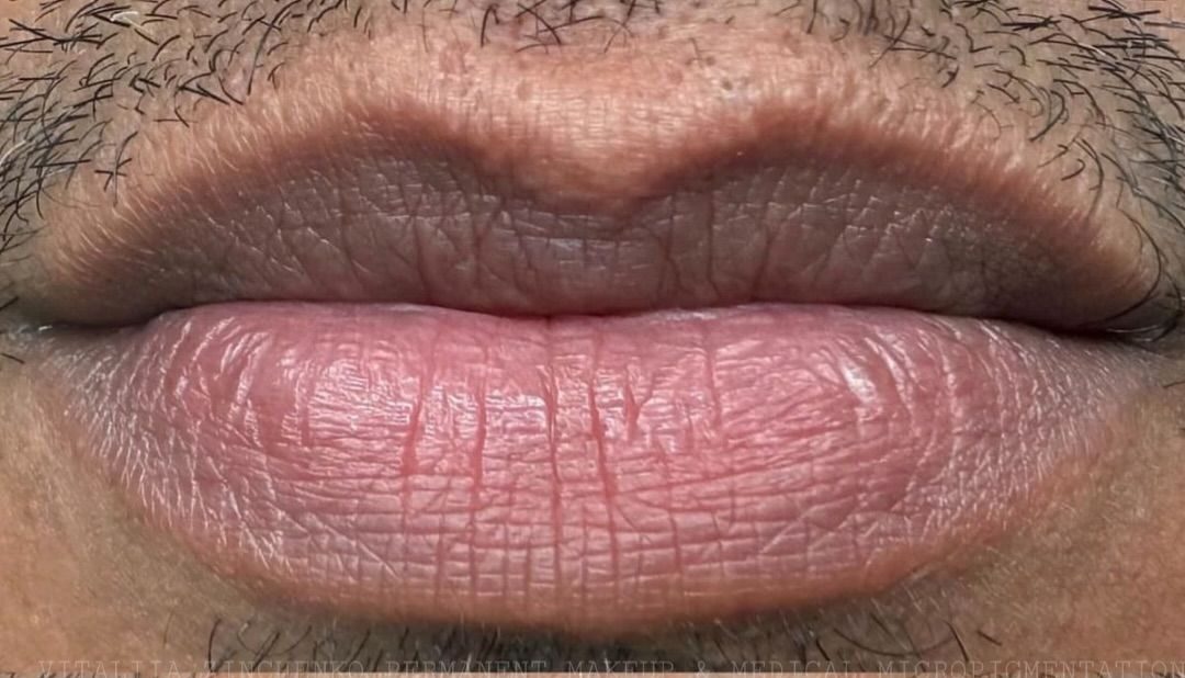 Kỹ thuật Dark-to-Light 2026 cho môi thâm