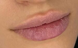 Những sai lầm khiến khử thâm môi không hiệu quả, dễ tái thâm