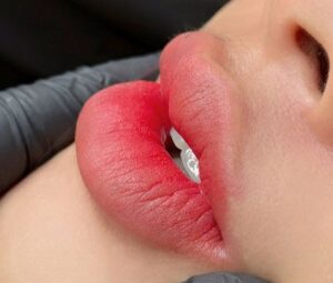 Phun Môi Collagen 2026: Hiệu ứng căng mọng có còn là ‘chuẩn đẹp’?