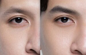 Phun mày Hairstroke phù hợp với da nào? Da dầu có nên làm không?