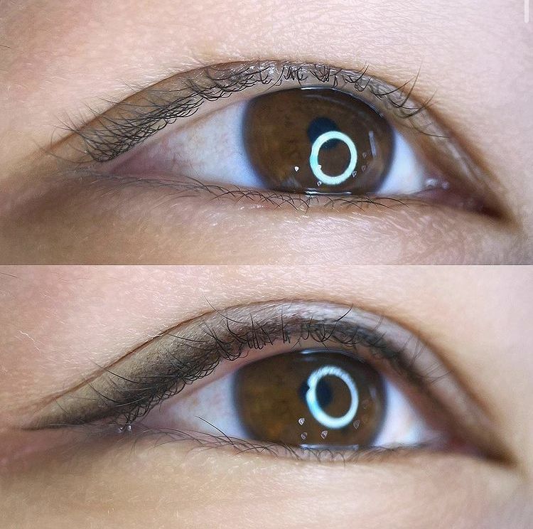 Phun mí mở tròng là gì? Có làm mắt to hơn thật không? 3 Phun mí nano khác gì phun mí truyền thống?