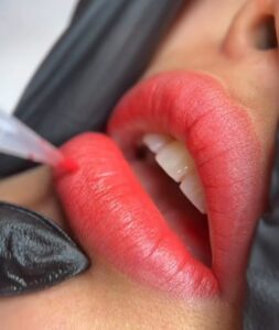 Phun môi có để lại sẹo không? Chuyên gia giải đáp 2026