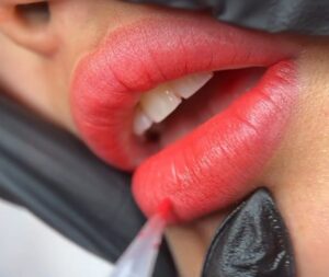 Phun môi có để lại sẹo không? Chuyên gia giải đáp 2026