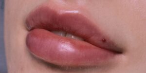 Phun môi không lên màu – Nguyên nhân 2026 và cách khắc phục tại spa