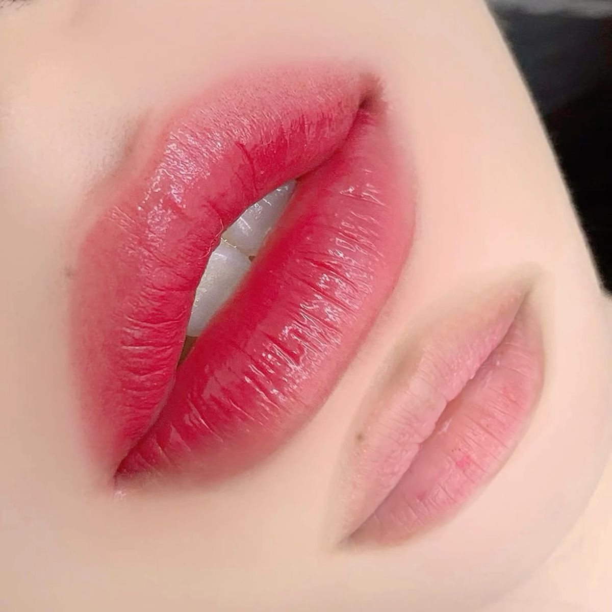 Phun môi đa tầng sắc tố: Xu hướng tạo màu ‘sống’ thay vì màu ‘đẹp' 4 Phun môi lên màu không đều có sửa được không? Giải pháp an toàn từ chuyên gia