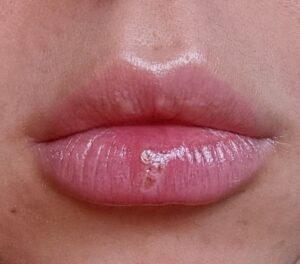 Tại sao không nên phun môi ở nơi giá rẻ? Cái giá phải trả không chỉ là tiền