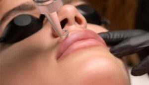 Xoá môi an toàn 2026: Tiêu chuẩn spa chất lượng