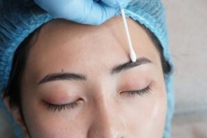 Xoá phun xăm bằng dung dịch 2026 – Có an toàn?