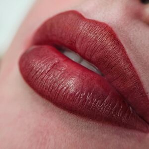 môi thâm lại sau phun