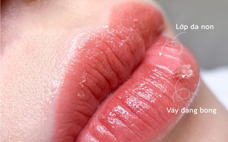 Phun môi có bị bong nhiều không?