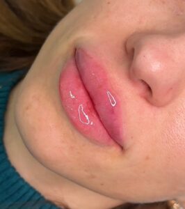 Quy trình phun môi màu hồng sữa tại spa: nhẹ nhàng, an toàn và chuẩn kỹ thuật