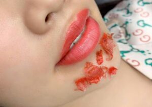 cong nghe phun xam organic e1764828476163