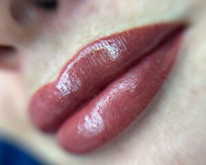 Hướng dẫn xử lý môi bị thâm lại tại spa: khi nào cần can thiệp?