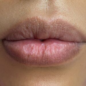 Môi thâm thường đi kèm môi khô – Vì sao khó bám mực khi phun môi?