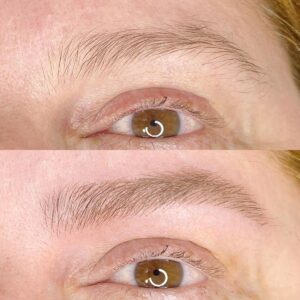 Sửa dáng lông mày đã phun nên xoá hay chỉnh lại?