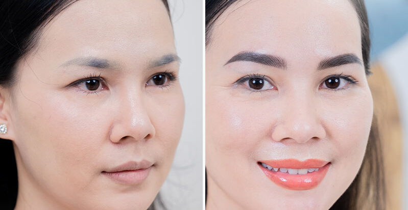 Dịch vụ sửa mày trung niên trọn gói