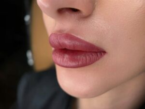 Xử lý môi bị thâm lại: nguyên nhân và cách khắc phục hiệu quả