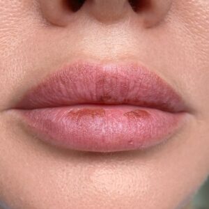 3 sai lầm khiến môi khô sau phun càng khô hơn (kèm cách khắc phục hiệu quả tại nhà)