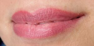 moi khong an muc xam e1764742739837