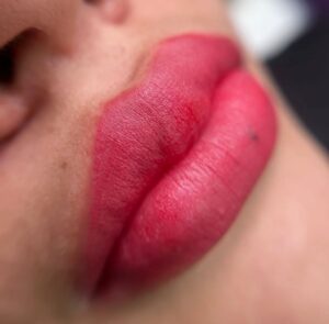 Phun môi bao lâu thì hết sưng? Khi nào là bình thường, khi nào cần đi khám 1 Phun xăm môi xong bị sưng: Bao lâu hết & có cần lo lắng?