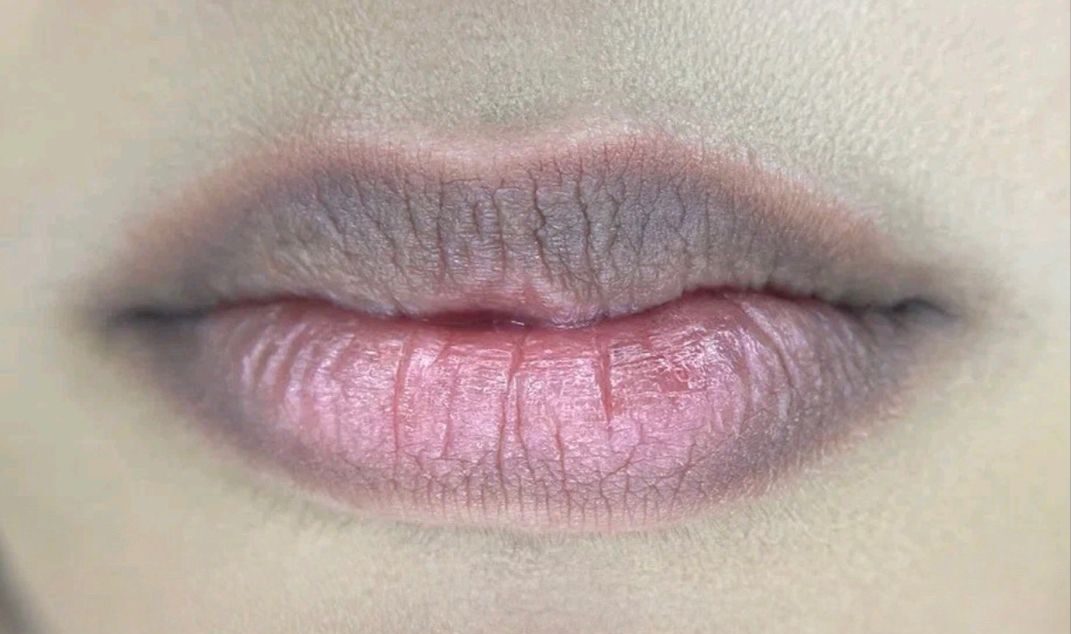 Tại sao phun xăm môi bị thâm sạm sau 1–2 tháng?