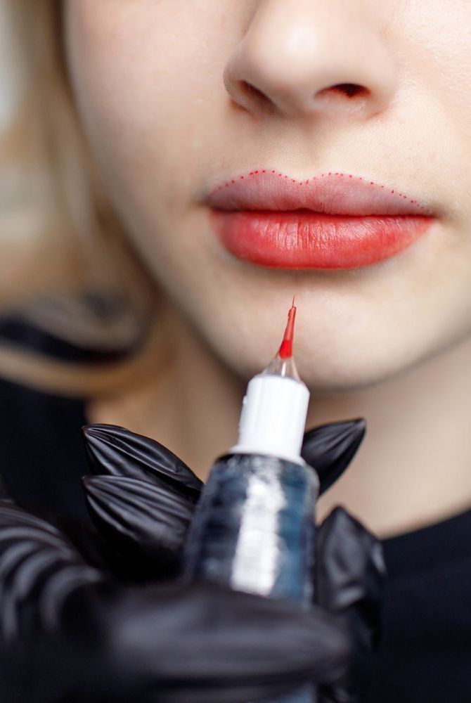 nguyen nhan phun xam moi bi tham