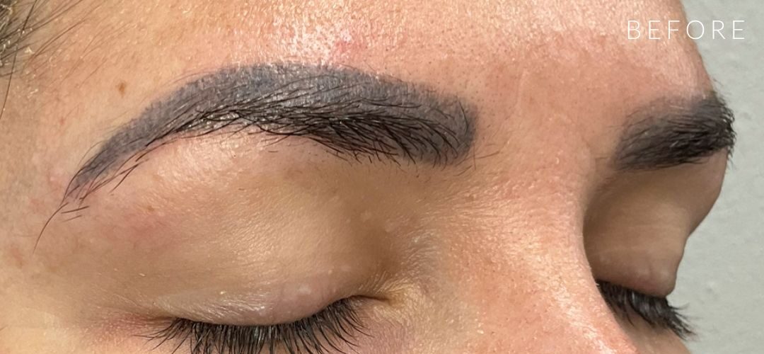 Những hậu quả thường gặp khi phun xăm giá rẻ và cách khắc phục