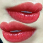 Phun môi collagen có tốt không? Ưu và nhược điểm cần biết