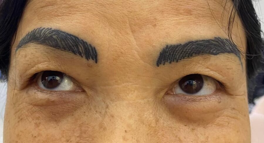 Phun xăm hỏng: 7 dấu hiệu nhận biết và cách xử lý kịp thời