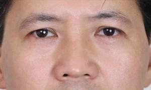 Chân mày nam bị nhạt màu – đây là giải pháp tốt nhất