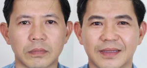 xam chan may nam dep them 22 scaled 1 e1764754825750