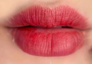 Xóa môi an toàn: Tiêu chuẩn dịch vụ 2026 bạn cần biết