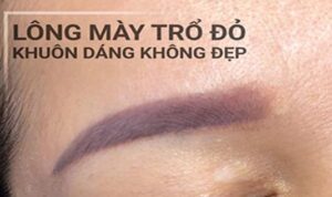 Chân mày cũ bị đỏ – xanh – tím: khi nào cần xóa, khi nào có thể chỉnh lại ngay?