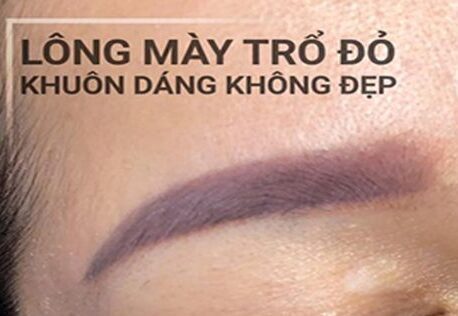 Phun mày bị trổ đỏ: khi nào cần xóa, khi nào có thể chỉnh lại ngay?