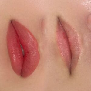 Phun môi nhìn tự nhiên hay giả? Câu trả lời phụ thuộc vào điều này