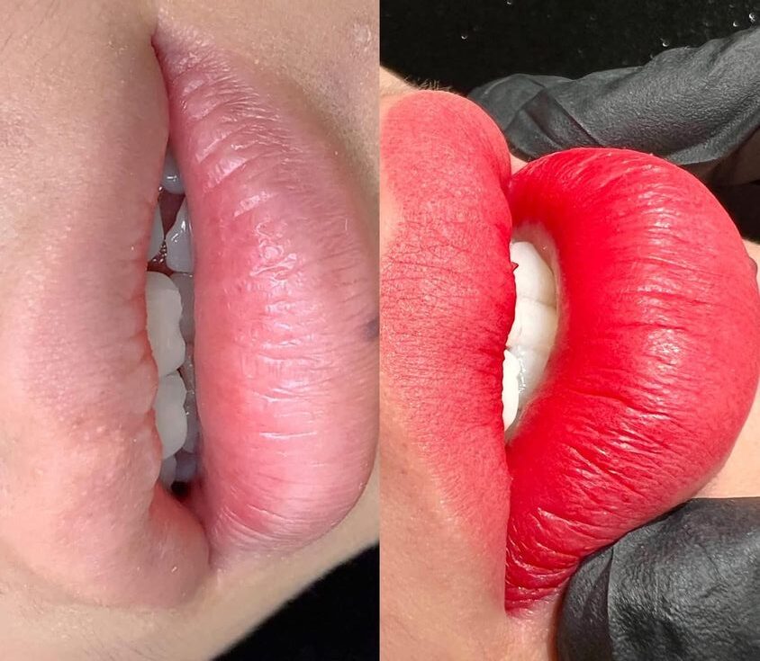 Top sai lầm khiến phun môi nhanh bị phai màu (và cách tránh!) 6 Có nên phun môi khi đang niềng răng? Những điều bạn cần biết!