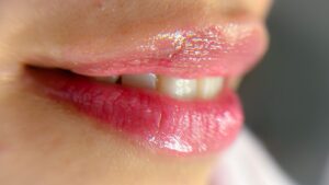 Phun môi màu hồng tươi có phù hợp với môi thâm không? Cần lưu ý gì?