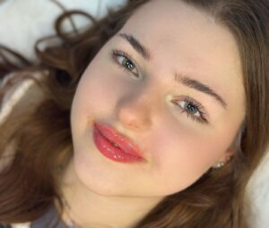 Ngủ nghiêng sau phun môi: nên hay không nên?