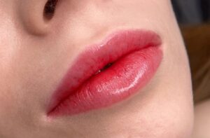 Phun môi kiêng gì? Danh sách food & beauty cần nhớ