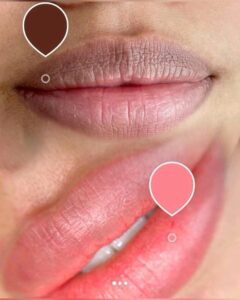 Khử thâm môi bao lâu thì hồng? Thời gian lên màu và lưu ý quan trọng