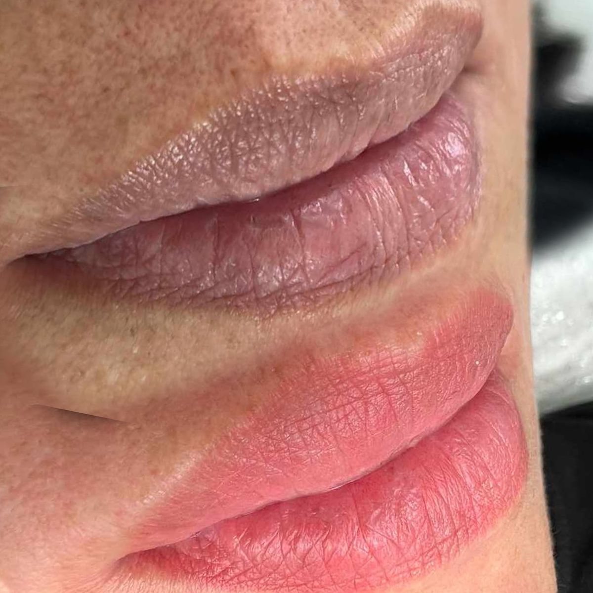 So sánh khử thâm môi công nghệ cao và phun môi truyền thống: Nên chọn phương pháp nào? 1 So sánh khử thâm môi công nghệ cao và phun môi truyền thống: Nên chọn phương pháp nào?