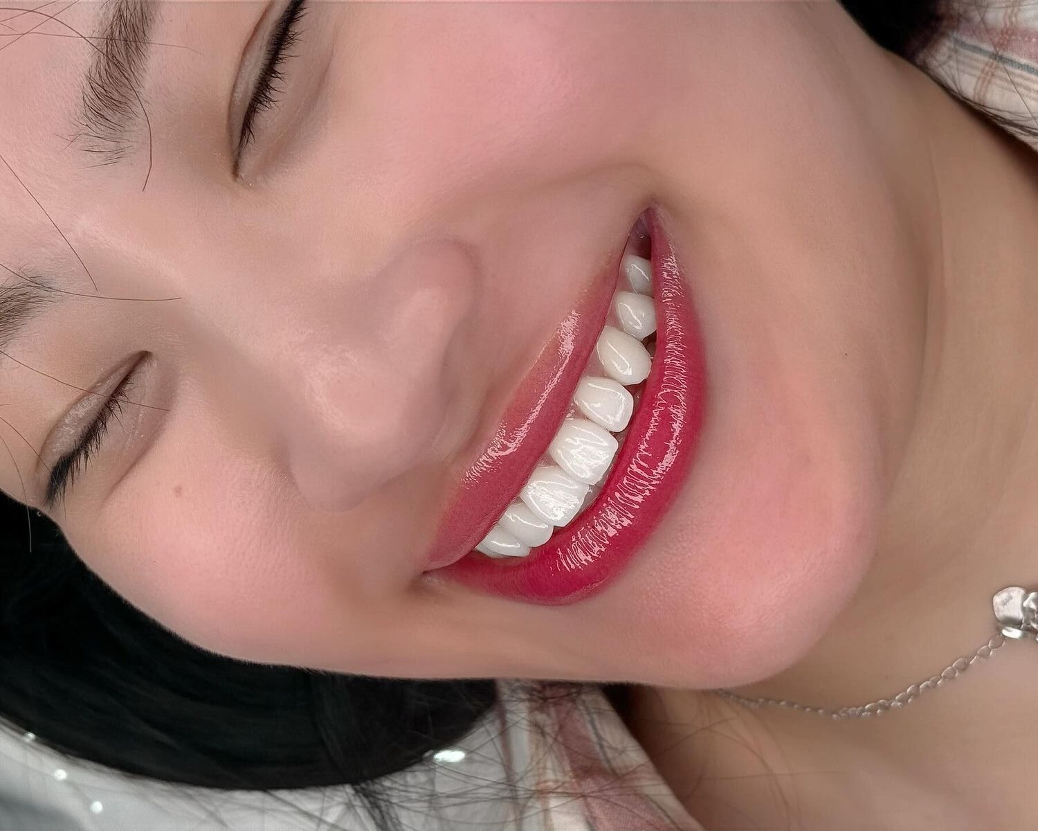 Môi thâm lâu năm có phun môi được không hay chỉ là lời quảng cáo?