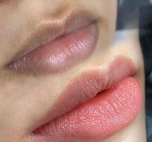 Quy trình khử thâm môi chuẩn spa giúp môi hồng hào tự nhiên lâu dài