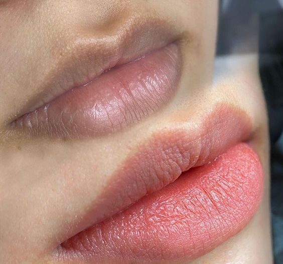 Quy trình khử thâm môi chuẩn spa giúp môi hồng hào tự nhiên lâu dài 1 Quy trình khử thâm môi chuẩn spa giúp môi hồng hào tự nhiên lâu dài