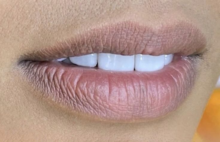 Các cấp độ thâm môi và cách xử lý trong phun xăm thẩm mỹ hiện nay